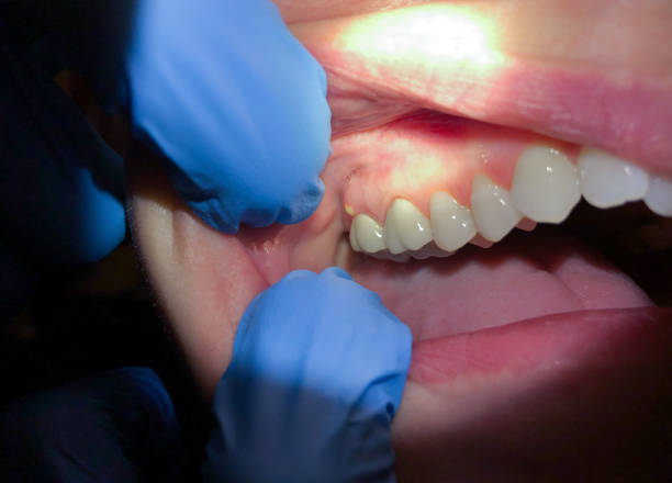Best Emergency Treatment for Toothache in Whitwell, TN