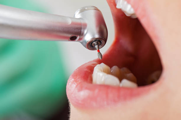 Best Pediatric Emergency Dentist in Whitwell, TN